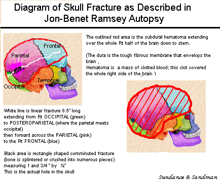 skull6.gif (30580 bytes)